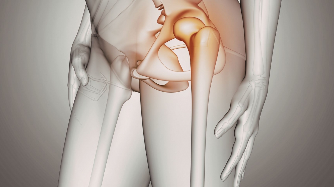 Rehabilitacion protesis cadera Barcelona