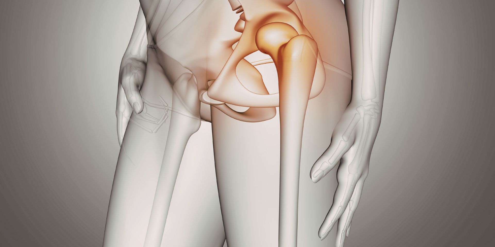rehabilitacion protesis cadera barcelona fisioterapia operacion cadera